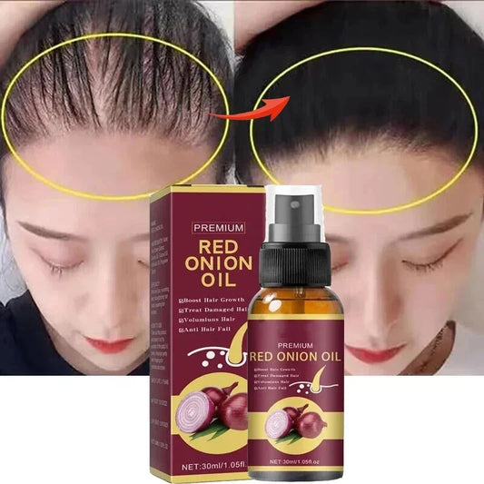 Powerful Hair Growth Serum Spray Nourish Root Hair Treatment Essence Anti Hair Loss Regrowth Repair Hair For Men Women Hair Care