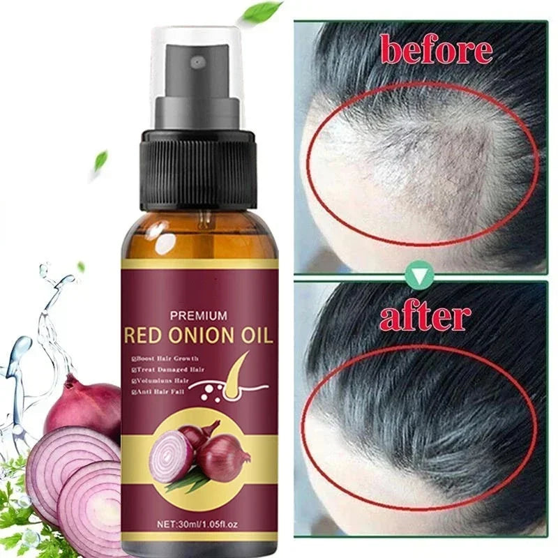 Powerful Hair Growth Serum Spray Nourish Root Hair Treatment Essence Anti Hair Loss Regrowth Repair Hair For Men Women Hair Care