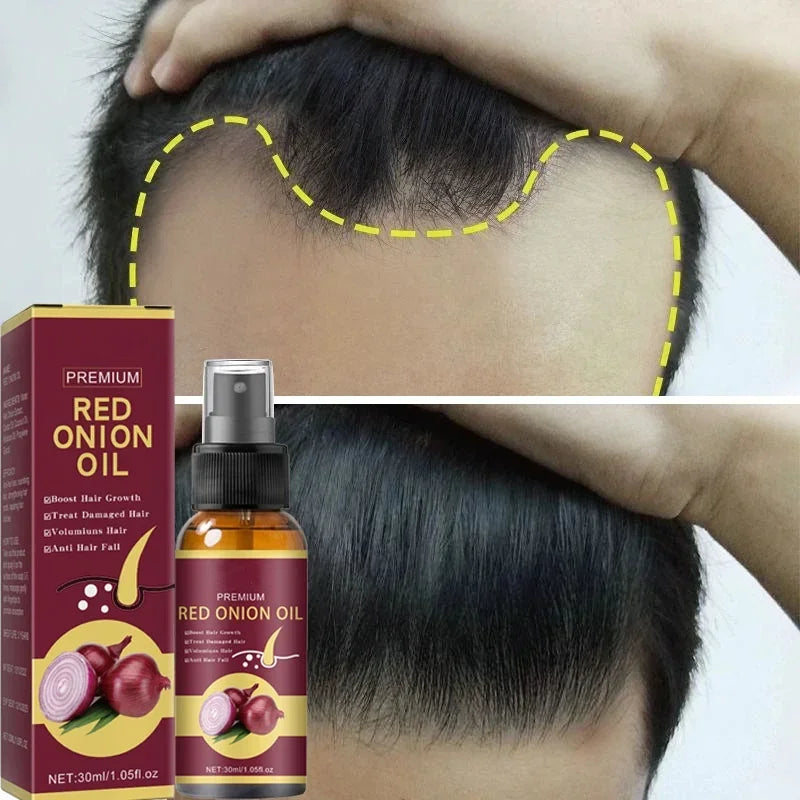 Powerful Hair Growth Serum Spray Nourish Root Hair Treatment Essence Anti Hair Loss Regrowth Repair Hair For Men Women Hair Care